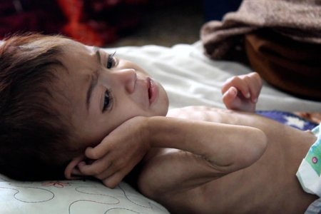 Hơn 3.000 trẻ em tàn tật, thiệt mạng do các cuộc chiến tranh xung đột