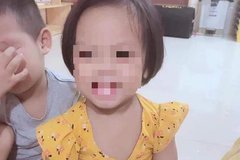 Xác định nghi phạm trong vụ bé gái 3 tuổi bị đinh găm hộp sọ