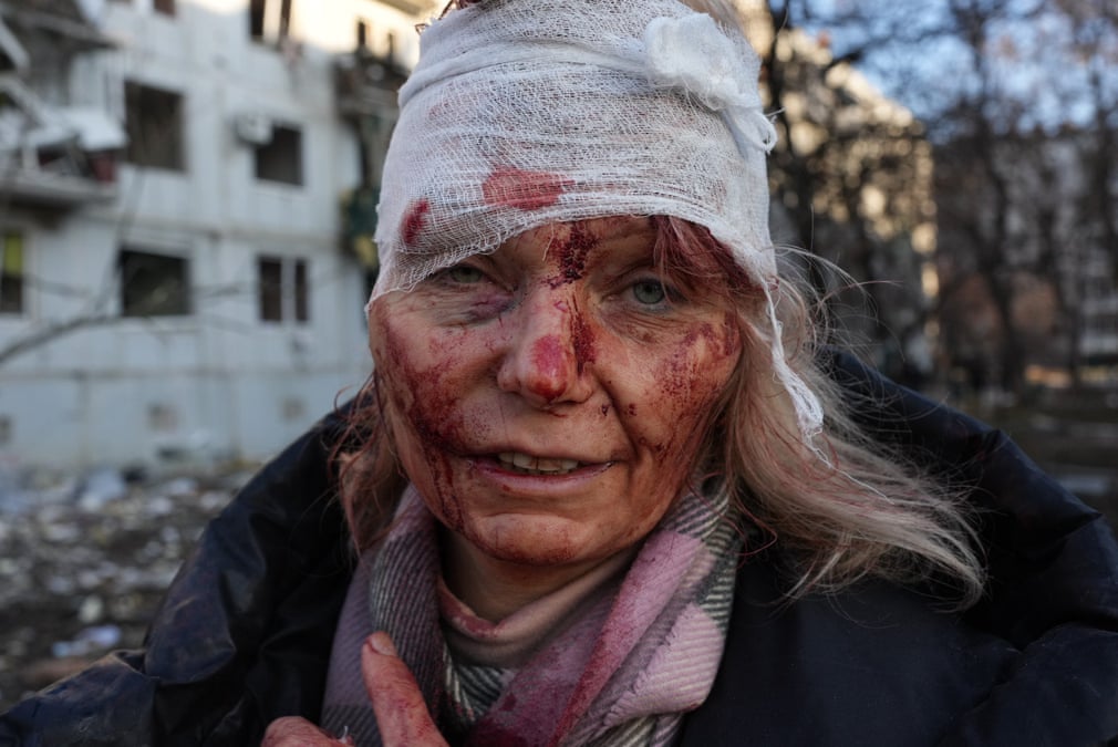 Ukraine ảm đạm, hàng chục người bị thương vong